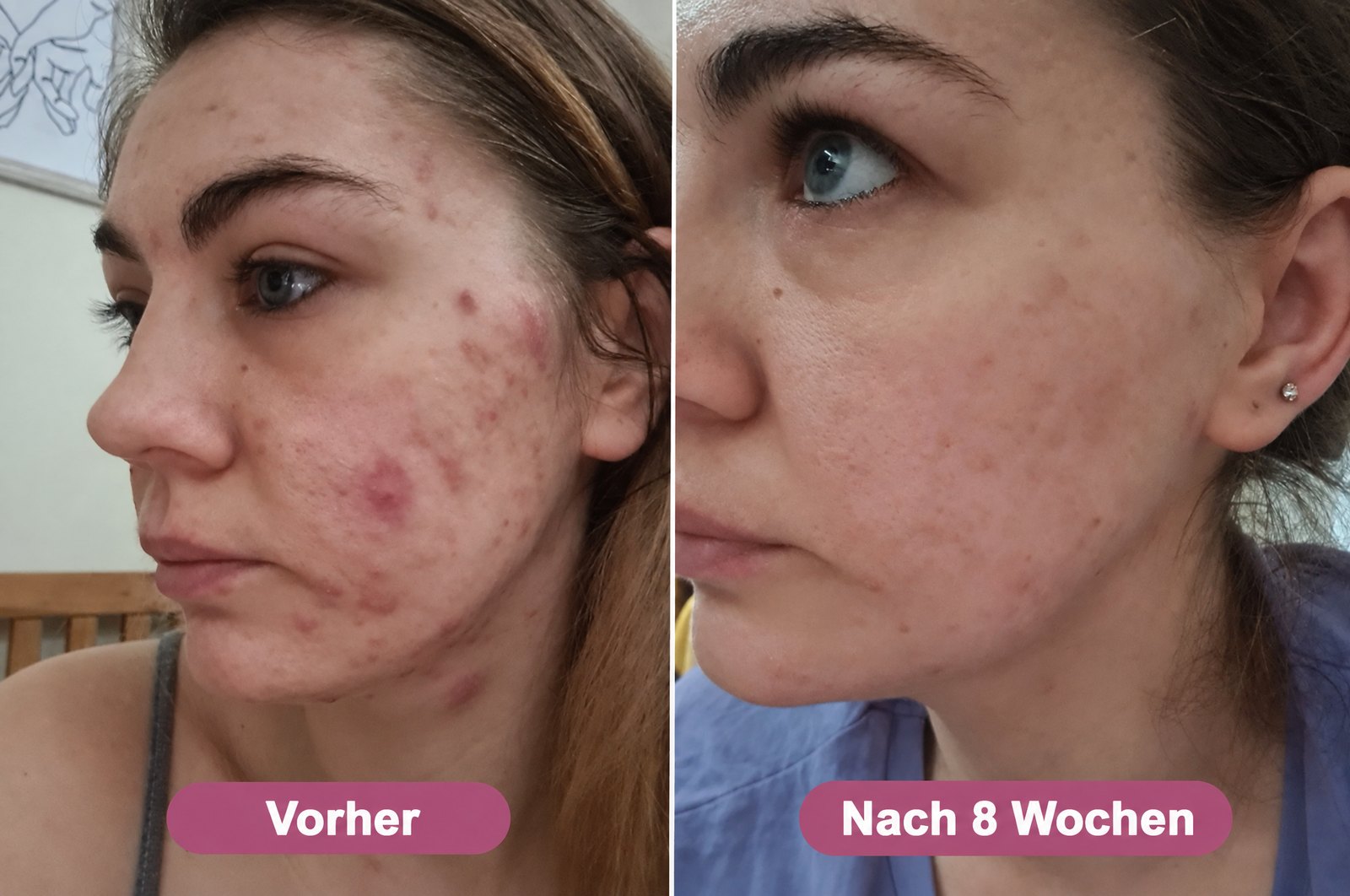 Vorher und nach 8 Wochen